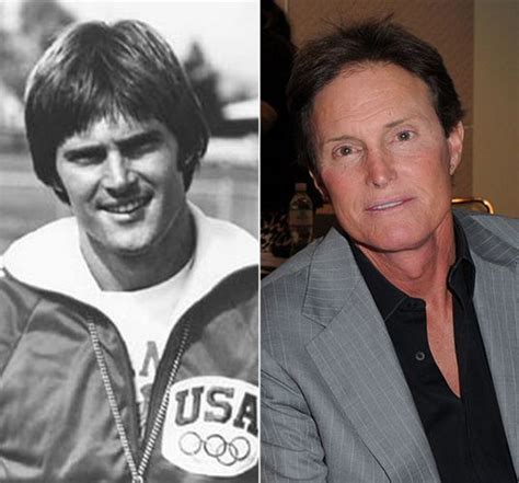 Bruce Jenner Before And After Plastic Surgery Creepy As All Get Out