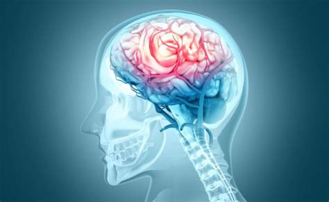 5 tihih simptoma koji ukazuju da se dogodio moždani udar bez najave