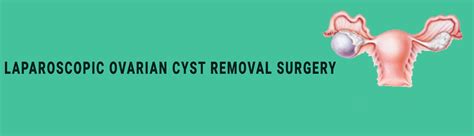 Laparoscopic Ovarian Cyst Removal Surgery Dr Gaurav Mishra General