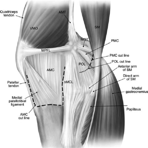 Medial View Of A Right Knee Illustrating The Medial Structures The