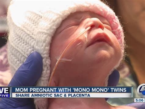just in time for mother s day orrville mom delivers rare set of mono mono identical twin girls