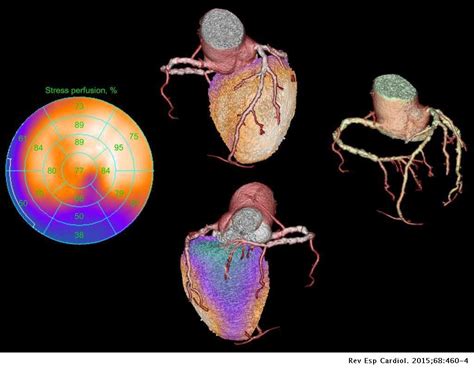 Nuclear Cardiology Role In The World Of Multimodality Cardiac Imaging
