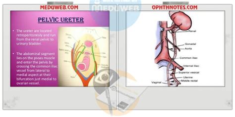 Pelvic ureter course, protection and congenital anomalies - Meduweb