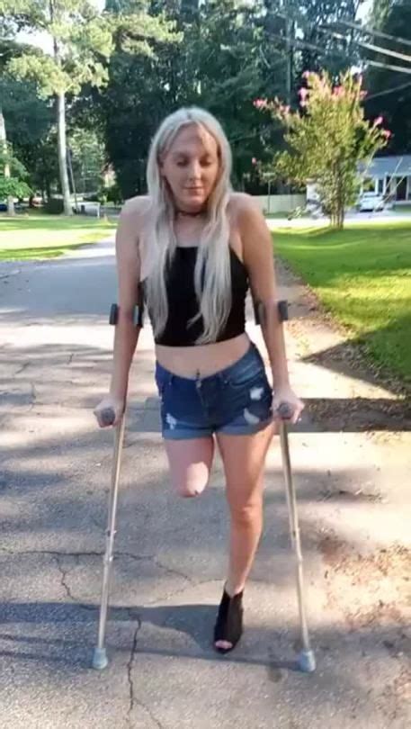 Amputee Legs Stumps And Prostheses In 2020 Amputee