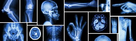 Download the perfect x ray pictures. X-Ray - Carlsbad Imaging Center - Imperial Radiology