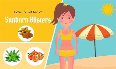 20 Tips How To Get Rid Of Sunburn Blisters On Nose Face Lips Skin Fast