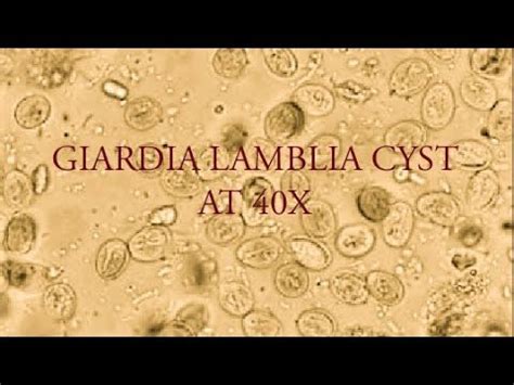 Giardia Lamblia Cyst Under Microscope At X YouTube