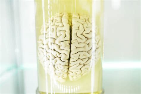 Brain Autopsy Stock Photos Pictures And Royalty Free Images Istock