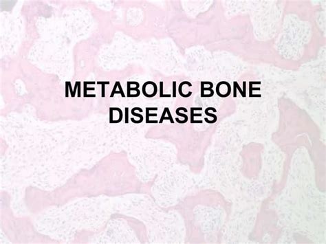 Metabolic Bone Diseases A Guide To Calcium Regulation And Bone