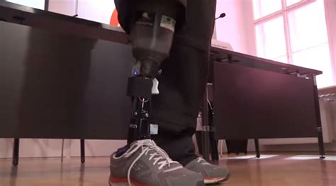 Prosthetics Breakthrough Lets Amputees Feel Their Artificial Limbs Good