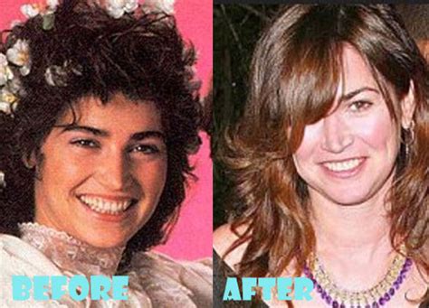 Kim Delaney Plastic Surgery Before And After Pictures Lovely Surgery