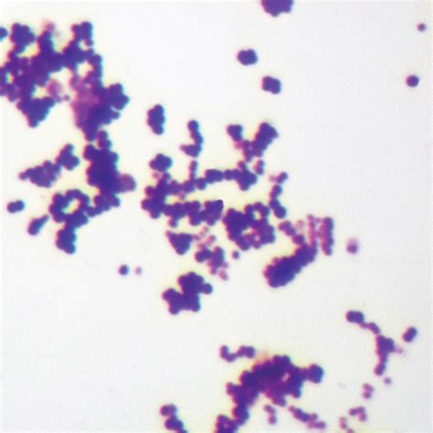 Mixed Gram Positive And Gram Negative Coccus Wm Gram Stain Microscope