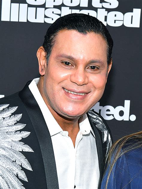 Sammy Sosa White Before And After