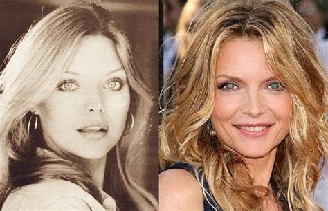 Michelle Pfeiffer Before And After Plastic Surgery Nose Face