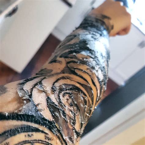 Peeling Tattoos Do Tattoos Fade When They Peel Gazzed
