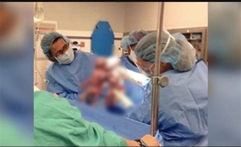 nurse screams after a woman gives birth mom takes a closer look at her twins and realizes this