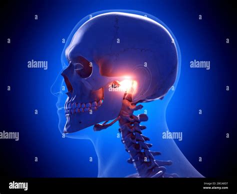 Painful Temporomandibular Joint Illustration Stock Photo Alamy