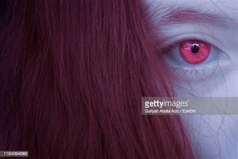 Pink Iris Eye Photos And Premium High Res Pictures Getty Images