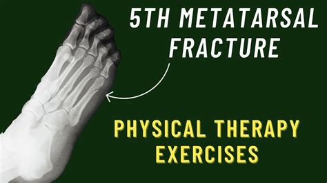 5th Metatarsal Fracture Exercises Jones Fracture Rehab Exercises