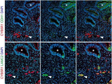 Confocal Immune Fluorescence For Cyb R Staining Of Individual