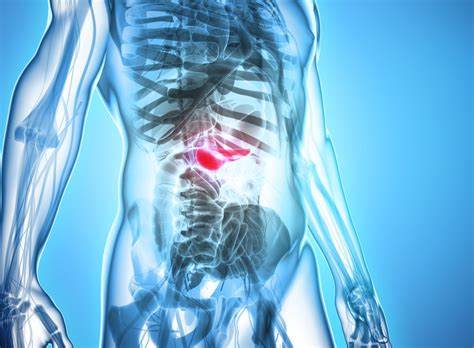 Хронического панкреатита лечение диета Хронический панкреатит: почему он возникает? | MedAboutMe Хронический панкреатит: почему он возникает? | MedAboutMe Хронического панкреатита лечение диета