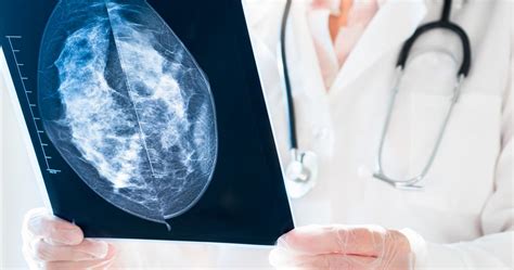 11 mammogram questions you re too shy to ask the university of vermont health network