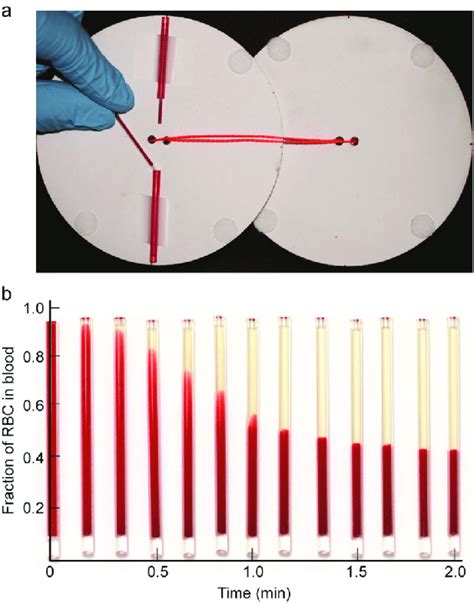 Paper Centrifuge For Whole Blood Processing Based On The Physics Of A