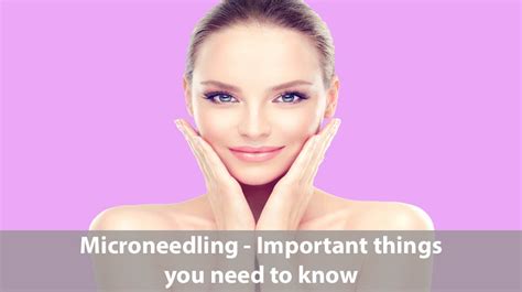Microneedling Important Things You Need To Know