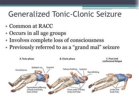 Generalized Seizure
