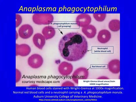 Anaplasmosis