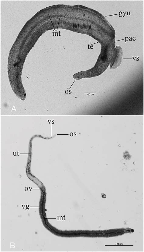 Enlarged Worm Picture A Male Showing Oral Sucker Os Ventral