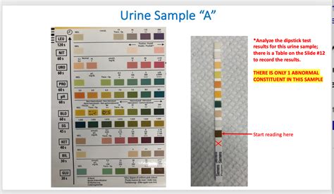 Urine Dipstick Results Chart Printable Fill Online Pr