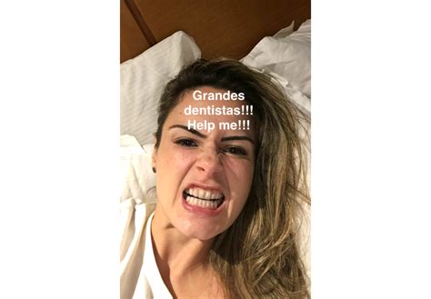 foto ex bbb ana paula renault publicou alguns vídeos em seu snapchat pedindo um tratamento