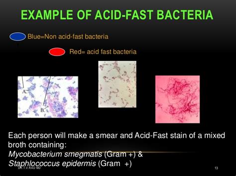 Acid Fast Bacteria Afb