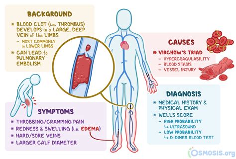 Deep Vein Thrombosis What Is It Causes Prevention And More Osmosis