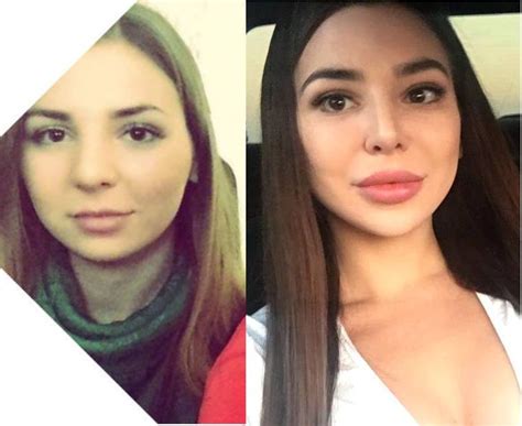 Photos See 90 Day Fiances Anfisa Nava Before Plastic Surgery 90