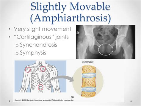 Types Of Synarthrosis Joints