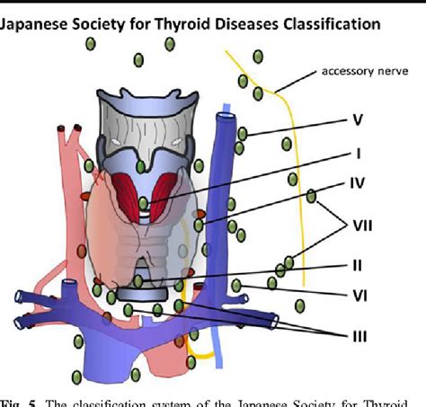Figure 1 From Classification Of Locoregional Lymph Nodes In Medullary