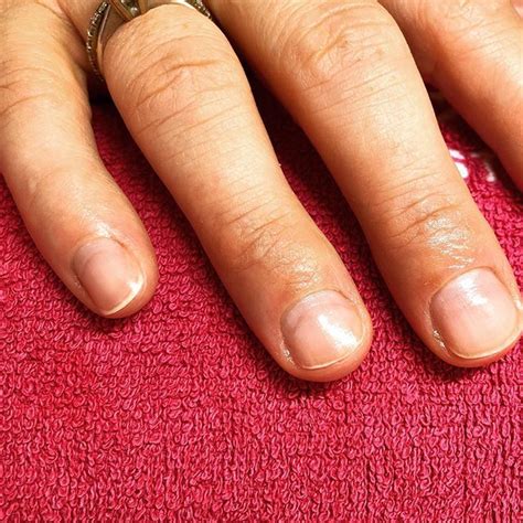 Nail Damage Does Your Manicurist Know How To Look After Your Nail Bed