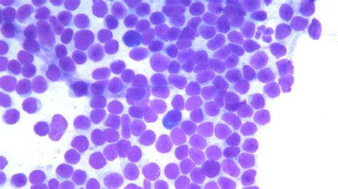 Small Cell Lymphoma In Cats Cat Choices