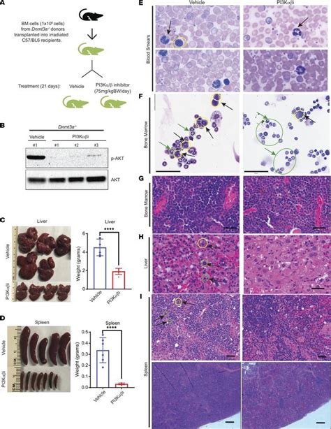 Jci Insight Loss Of Dnmt3a Impairs Hematopoietic Homeostasis And