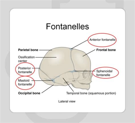 The Fontanelles Medizzy