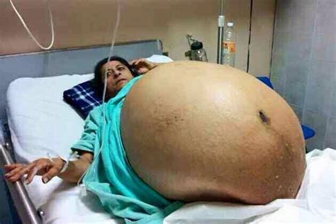 The Mother Who Is Still In Good Health And Waiting To Give Birth
