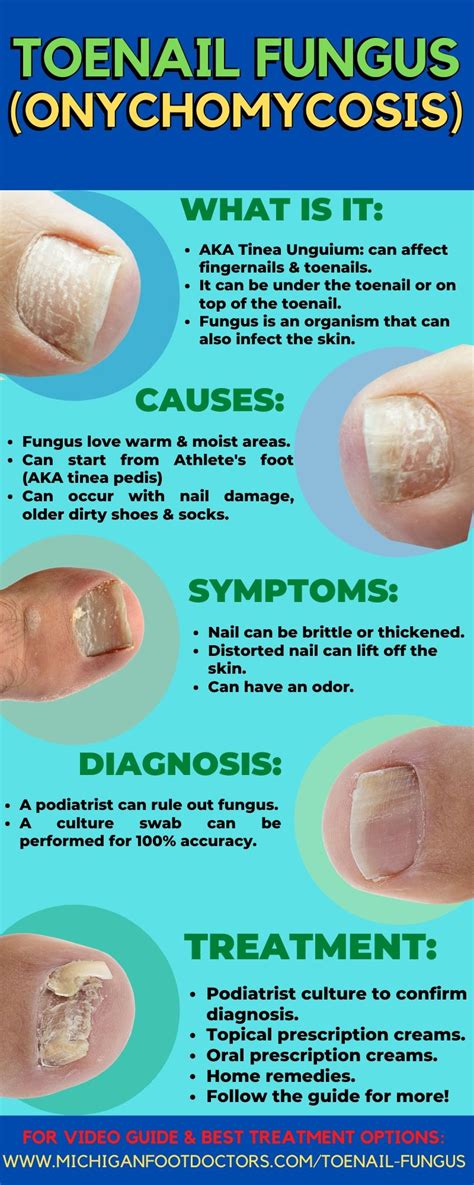 What Is The Cause Of Nail Fungus Home Design Ideas