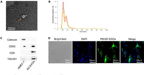 Figure From Vascular Endothelial Cells Derived Exosomes Synergize