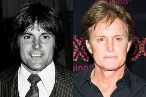 Bruce Jenner Plastic Surgery Before And After Plastic Surgery Stars