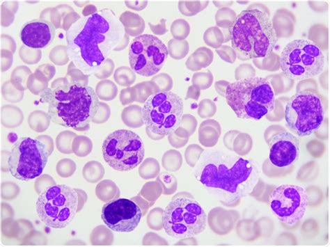 Does Covid 19 Infect Peripheral Blood Cells Sound