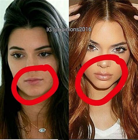 Kendall Jenner Before And After Archives Ghanacelebritiescom