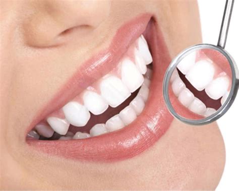 Estética Dental Clínica Dental Lanchares
