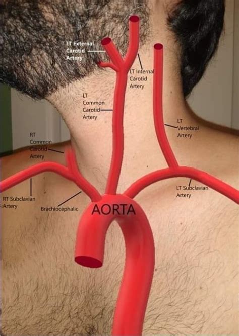 Pin On Interventional Radiology